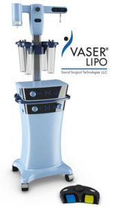 aparelho de lipo hd, máquina que faz lipo hd