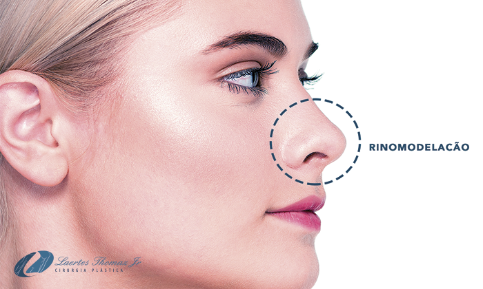 rinoplastia e rinomodelação