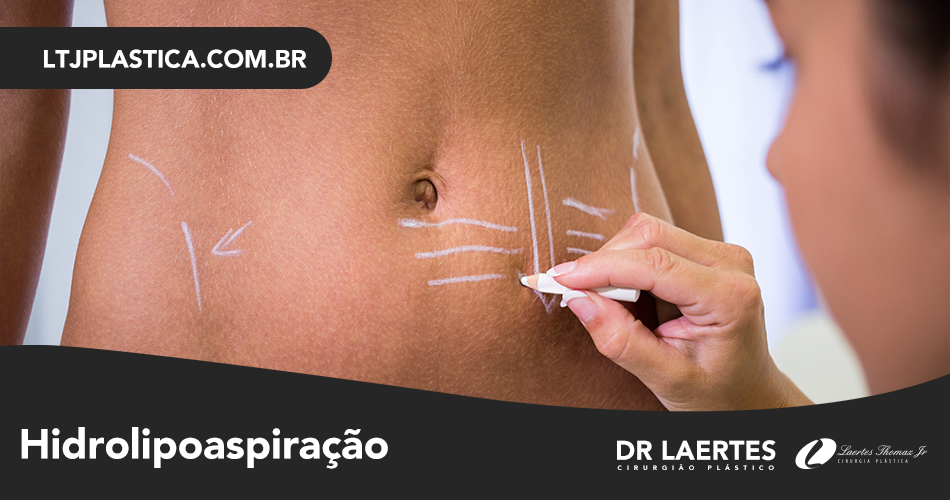 hidrolipo em são paulo