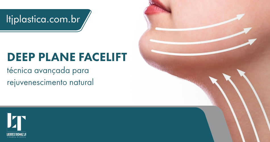 deep plane facelift são paulo