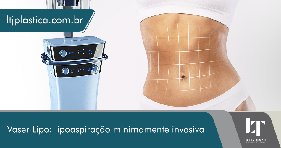 vaser lipo são paulo