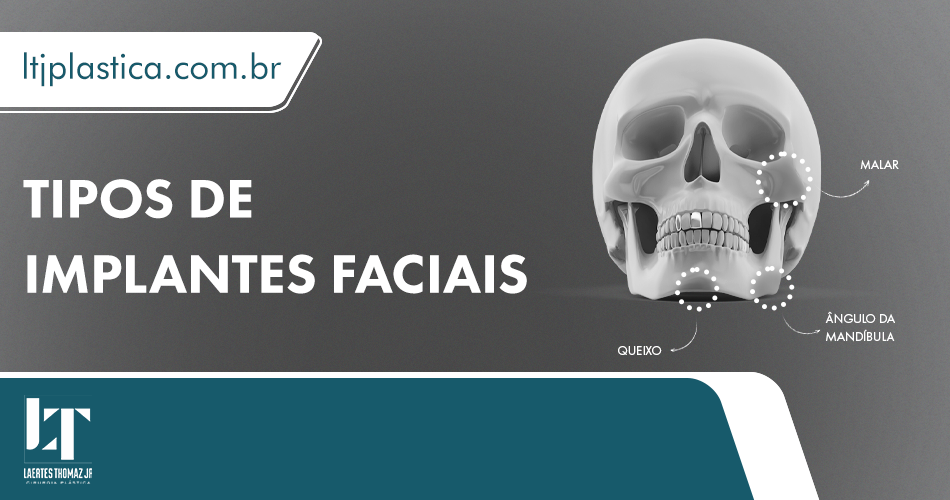 cirurgia plástica são paulo implantes faciais
