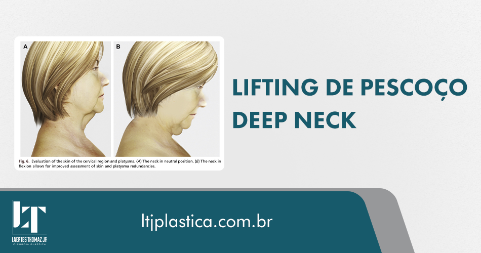 cirurgia plástica facial são paulo