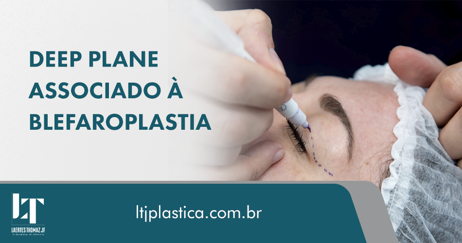 cirurgia plástica são paulo depp plane blefaroplastia