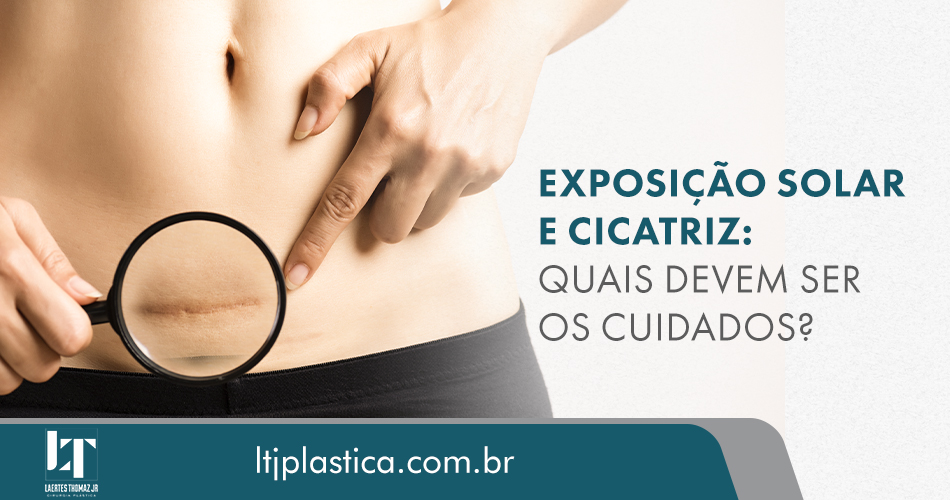 cicatriz cirurgia plástica são paulo dr. laertes thomaz jr.