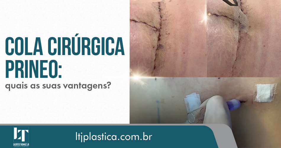 cirurgia plástica são paulo cola cirúrgica prineo