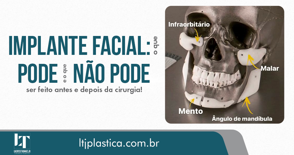 cirurgia plástica são paulo implante facial