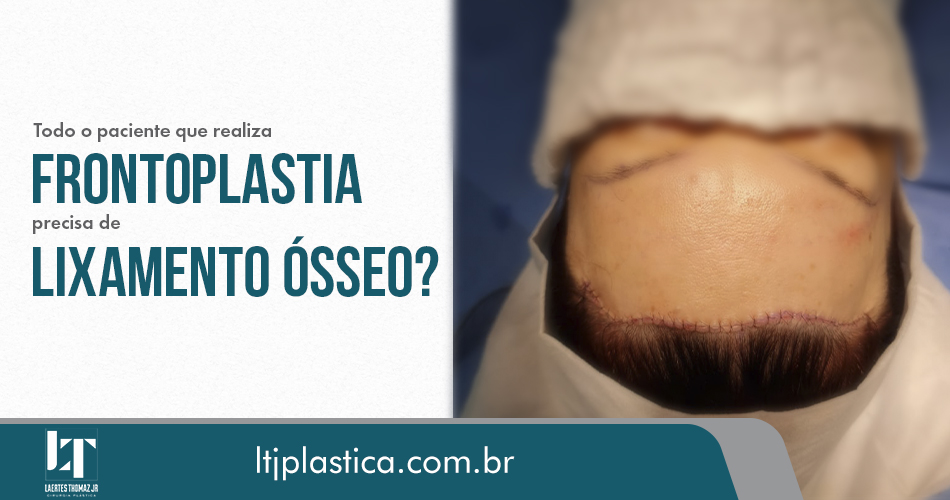 cirurgia plástica são paulo frontoplastia