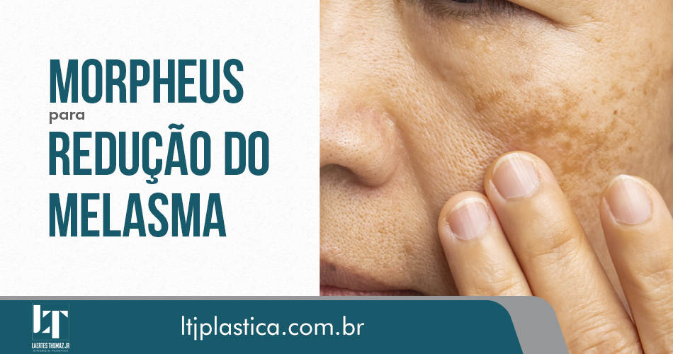 cirurgia plástica são paulo morpheus